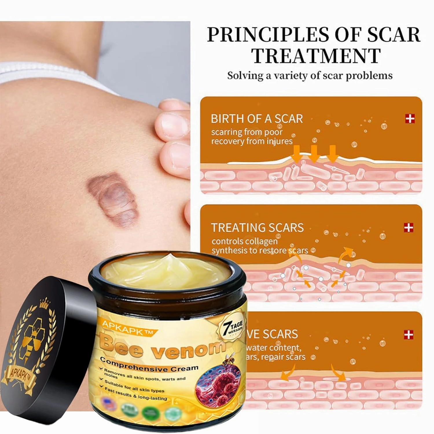 Bee Venom Comprehensive Cream, 2025 New Bee Venom Skin Treatment Cream, Bee Venom Cream-50g, Natural Skin Moisturizer for All Skin Types (2)