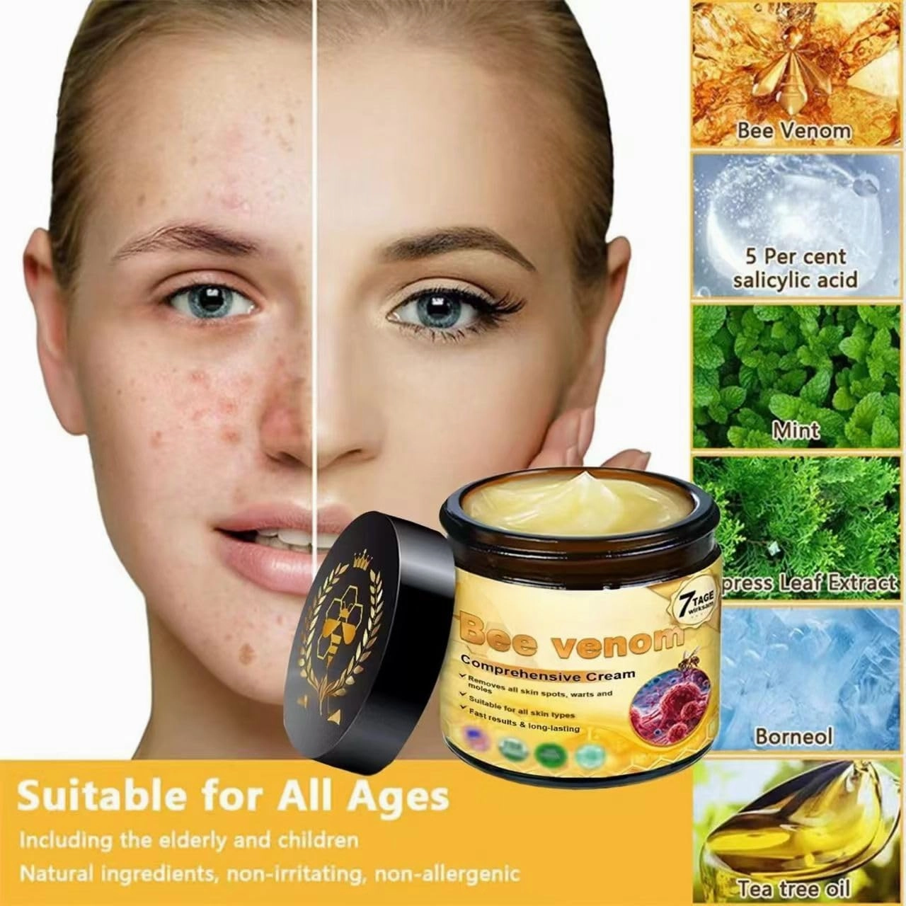 Bee Venom Comprehensive Cream,2025 New Bee Venom Skin Treatment Cream, Bee Venom Cream-50g, Natural Skin Moisturizer for Face and Body
