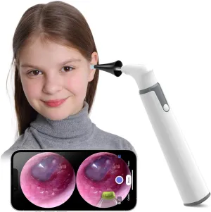 Wireless Otoscope Ear Camera with Dual View, 3.9mm 720PHD WiFi Ear Scope with 6 LED Lights, Otoscope Camera for Kids and Adults, Compatible with Android and iPhone